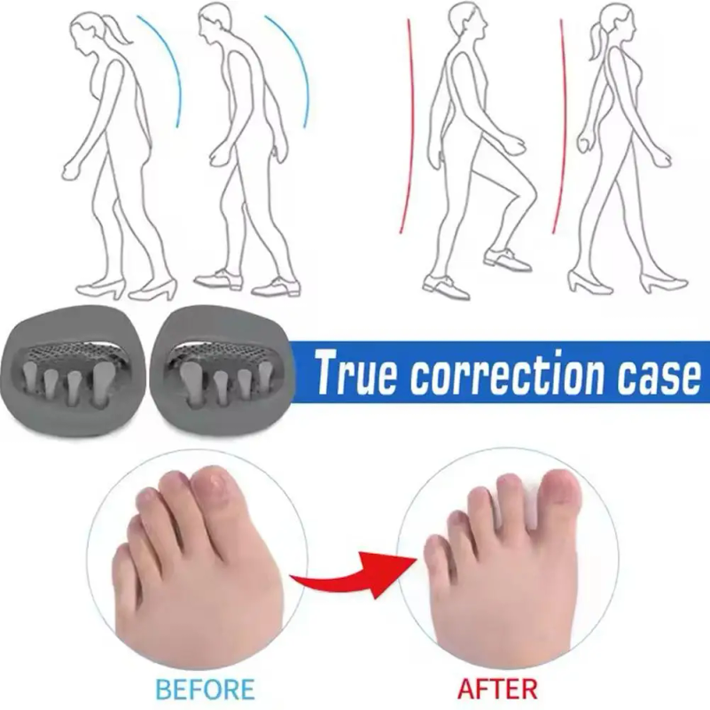 Zapatillas Correctoras de Pier - Home Improvement Man reseña y precio